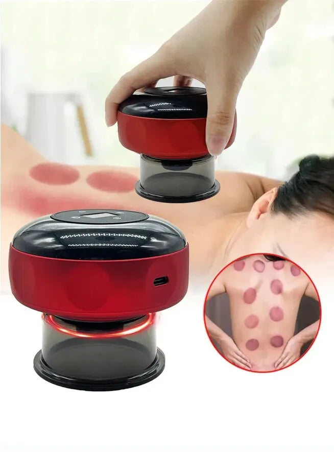 Smart Electric Vacuum Cupping